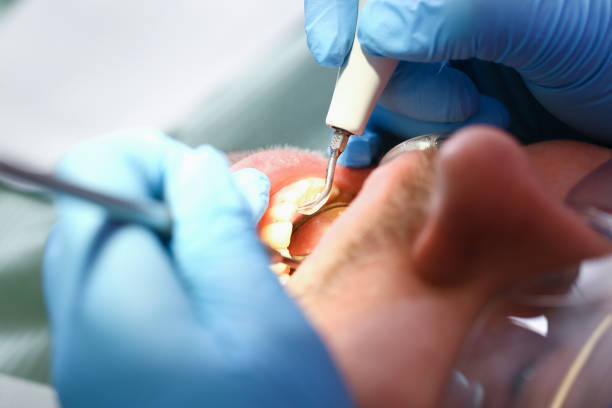 Best Pediatric Emergency Dentist in Lenoir, NC