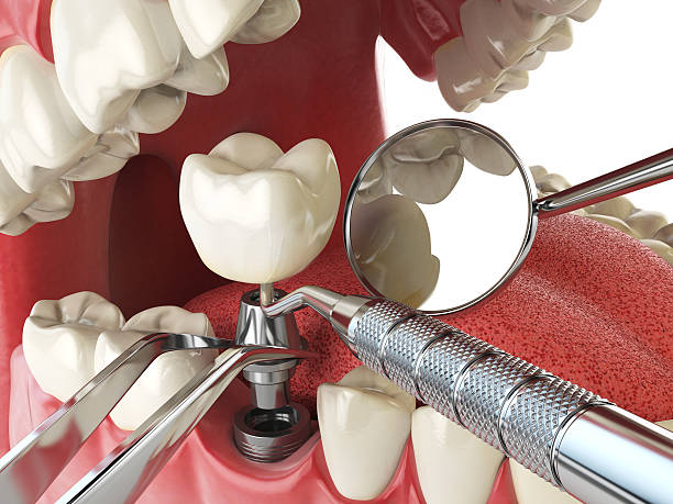 Best Emergency Dental Care for Trauma or Injury in Lenoir, NC